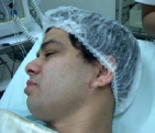 Micosis