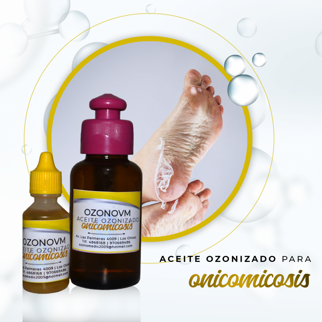 Productos-Aceite_Ozonizado_anicomicosis