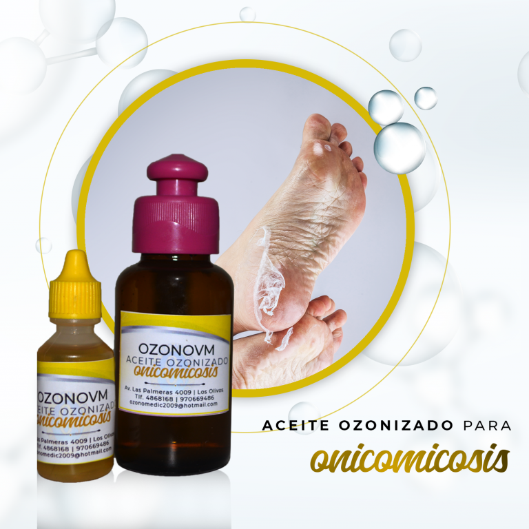 ACEITE OZONIZADO ANICOMICOSIS - VMOzonomedic